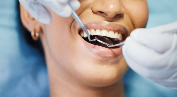 Best Knocked-Out Tooth Emergency  in West Hill, OH